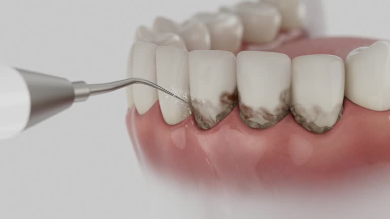 Reliable Dental Implants contractor in Glasgow, OR by Smile Center Dentistry